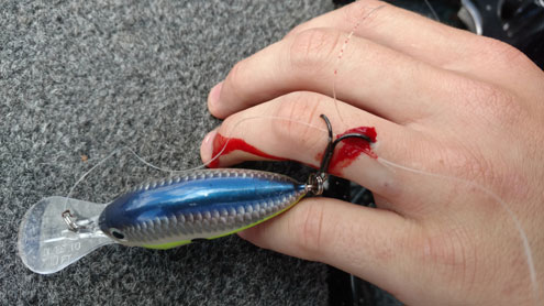 Don't get hooked: It's no fun being an angler on the business end of a fish  hook - North Texas e-News